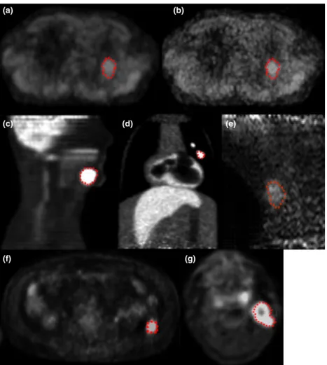 Figure 2 shows examples of the PET images available in PETASset including the associated RCs.