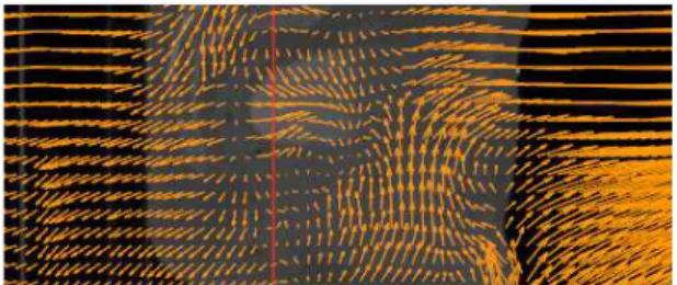 Figure 4. Example of the resulting transformation (deformation field, D) used to map the dose