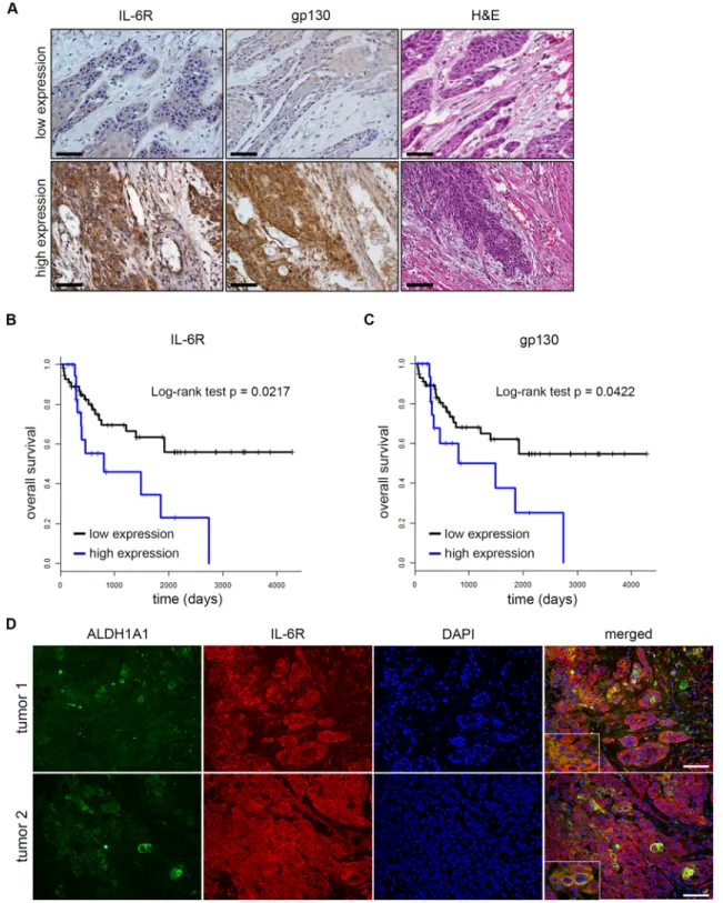 Figure 1: Expression of IL-6R or gp130 correlates with HNSCC patient outcome.  (A) Representative immunohistochemistry  staining of low and high expression IL-6R and gp130 and corresponding hematoxilin and eosin (H&amp;E) staining