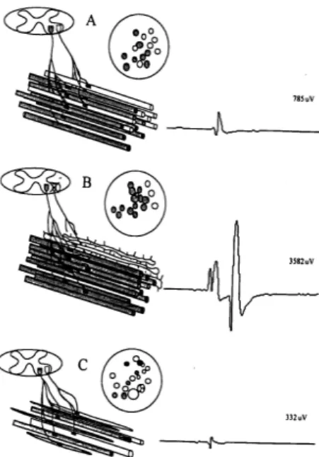 Figure 1.2: Schematic representation of the effects of the various categories of neuromuscular disorders [Farkas et al., 2010]