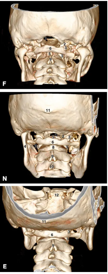 Figure 2. The posterior view of the craniovertebral junction in the flexion (three-dimensional multislice computed tomography images in F), the neutral position (N), and extension (E); 1 — the foramen magnum; 2 — the right occipital condyle; 3 — the right 