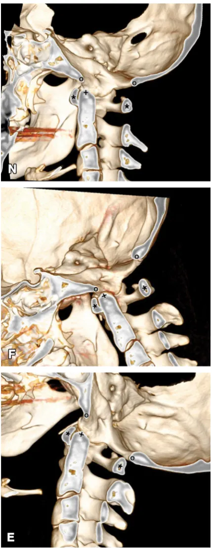 Table 3. Distances [mm] within the craniovertebral junction in extension