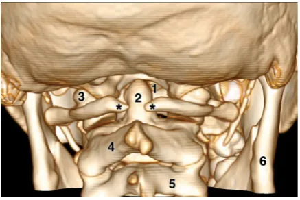 Figure 6. Posterior view of the skull and the cervical spine to show a partial agenesis of the posterior atlas arch (between the two asterisks); 1 — the foramen magnum; 2 — the odontoid process (dens); 3 — the lateral mass of the atlas; 4 — the arch of the