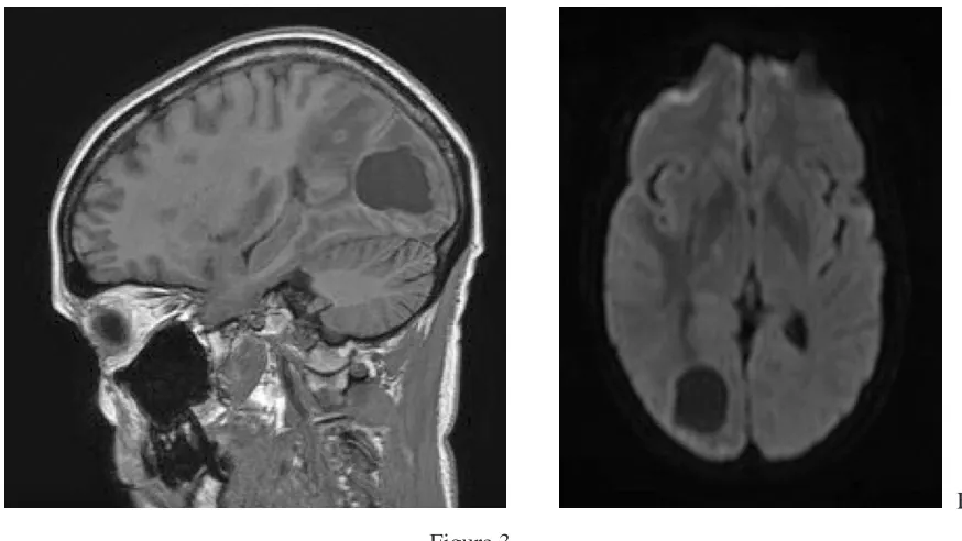 Figure 3A Figure 3B
