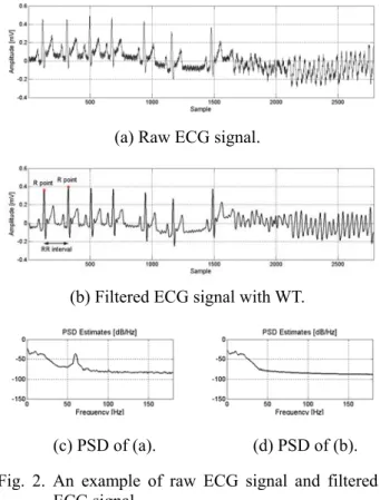 Fig. 2. An example of raw ECG signal and filtered  ECG signal. 