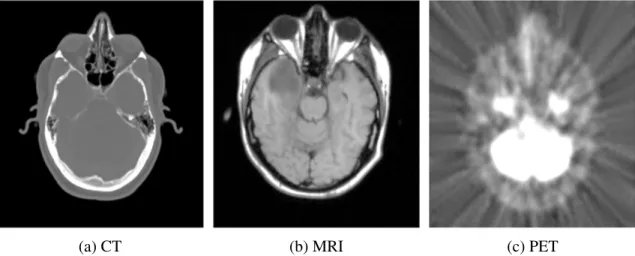 Figure 1.2: Brain images acquired from different imaging modalities. Note the variation in the appearance of the anatomy.