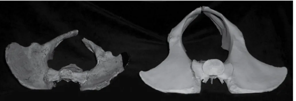 Figure 1.  Pelvis of Australopithecus africanus specimen Sts 14 (left).  The right side of the  Sts 14 sacrum was mirrored from the left, and the bottom three vertebrae were missing, but  have been reconstructed
