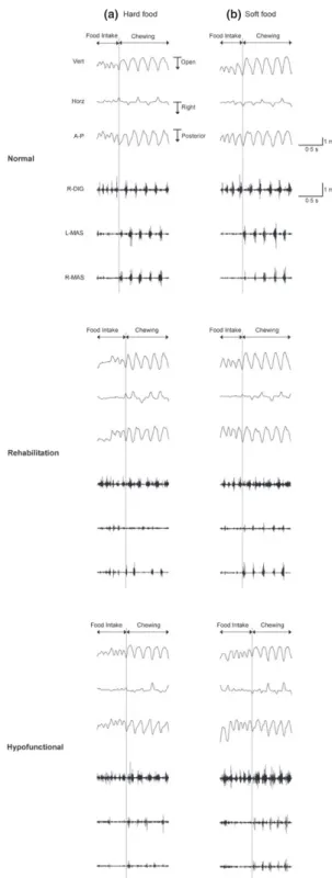 Fig. 1. Typical masticatory sequence. (a) chewing of hard food, (b) chewing of soft food