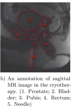 Figure 1.2: MR image example of prostate
