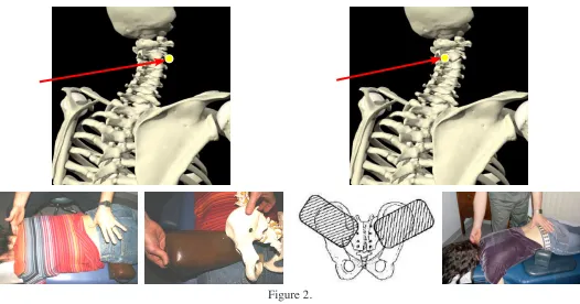 Figure 2. Orthopedic Block Placement