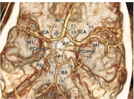 Figure 4. Superior, and slightly posterior and right view of the main cerebral arteries at the base of the skull in a 3-dimensional recon-struction of the cerebral angiograms; VA — right and left vertebral arteries; BA — basilar artery; P1 — proximal segme