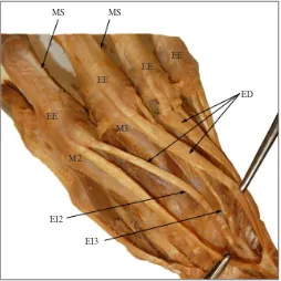 Figure 2 The distal attachments of the EI double tendon. On the dorsum of the hand, opposite the heads of the second metacarpal (M2) and the third metacarpal (M3) bones, the tendons of the EI to the second (EI2), and third (EI3) digits join the ulnar sides of the ED, enhancing the medial slips (MS) of the extensor expansion (EE) of the second and third digits.