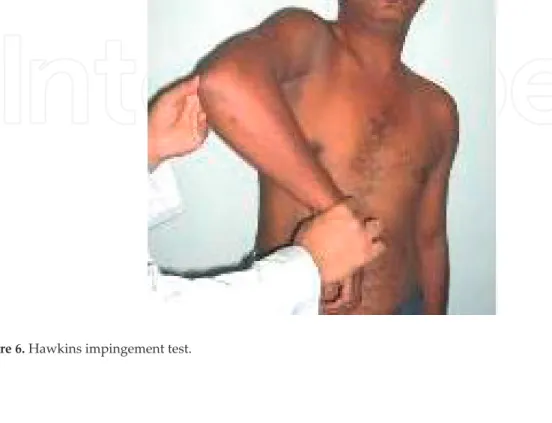 Figure 6. Hawkins impingement test.