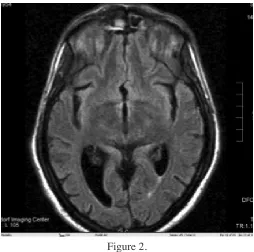 Figure 1. Figure 2. 