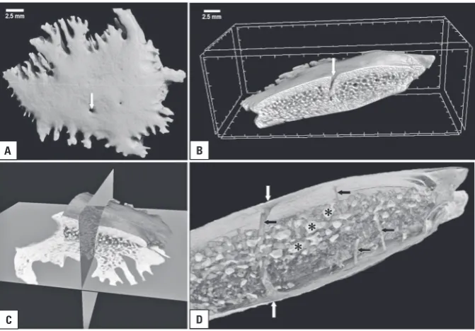Figure 2. External and internal morphology of the Wormian bone reconstructed from high-resolution micro-computed tomography scans by partially the external surface of the bone and its interior in the axial and horizontal projection; volume rendering; A