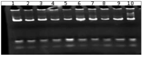 Fig. 1: The electrophoresis pattern of genomic DNA extracted 