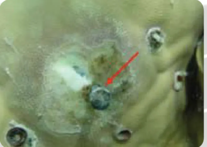 Figure 9.  A masonry nail (arrow) hammered into dead  skeleton can provide a useful reference point and scale for  monitoring disease progression in an active lesion