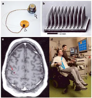 Figure 3: a) The BrainGate sensor resting on a US penny and the percutaneous pedestal which connects the sensor to the rest of the system