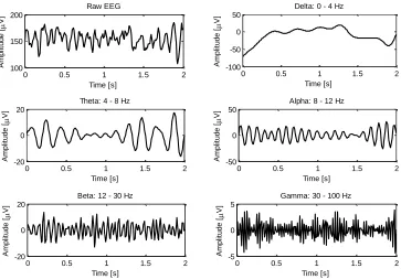 Figure 6: Typical brainwaves and their associated frequency bands. Notice the inverse relation between amplitude and frequency 