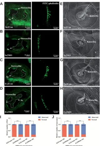 Fig. 3. Cilia damage in Msrb3neuromasts of morphants were damaged (not see in controls)