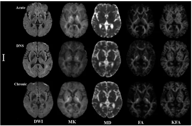 FIG 2. Boxplots of diffusional kurtosis imaging in ROIs in the acute phase (red bar), DNS phase (green bar), and chronic phase (blue bar)with CO intoxication