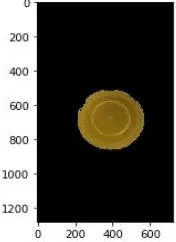 Fig. 11  Final Segmented Image using Ostu’s Algorithmn 