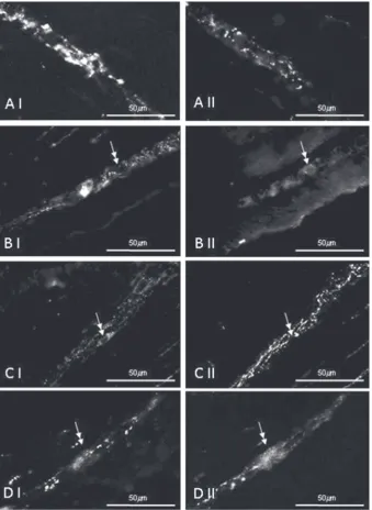 Figure 1. Co-localisation of cocaine- and amphetamine-regulated transcript (CART) (I) and VIP (II) in the myenteric plexus of the porcine transverse colon; A
