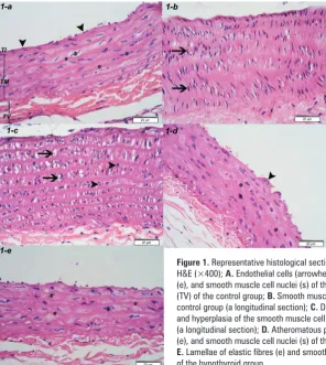 Figure 1. Representative histological sections of the wall of the thoracic aorta stained with (e), and smooth muscle cell nuclei (s) of the tunica media of the hyperthyroid group;  E.and hyperplasia of the smooth muscle cell nuclei of the hyperthyroid grou