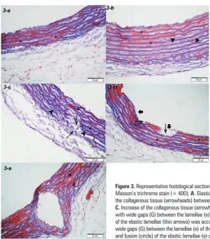 Figure 2. Representative histological sections of the wall of the thoracic aorta stained with 