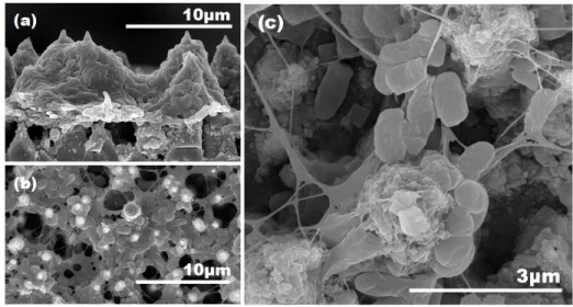 Figure 2.3 SEM images of bacterial growth after operation 