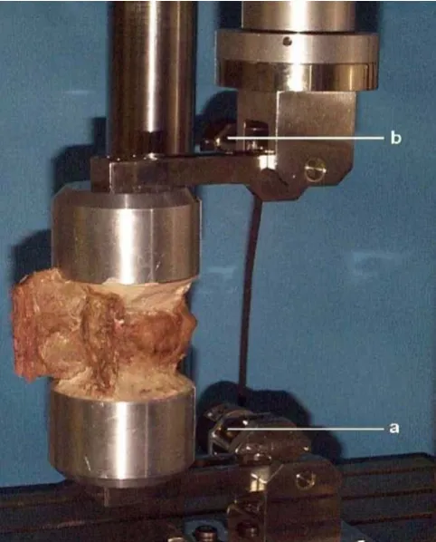Figure 6The cadaver spine specimens fixed with the cylindrical cages (A) and rectangular cages (B), and mounted in the eccentric load-ing jig rotated 90� to test the lateral bending movements