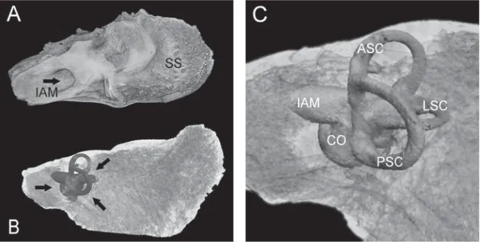 Figure 1. A. Volume reconstruction of the right petrous bone, visible medial surface; IAM — internal acoustic meatus; SS — sigmoidsulcus; B