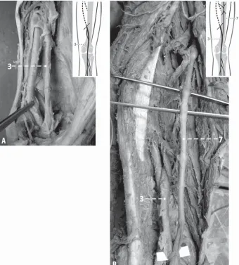 Figure 3. Microphotographs of variations in the patterns of deep venous system distribution within the popliteal fossa