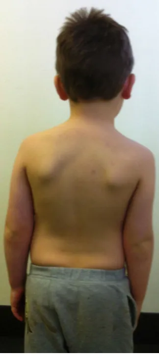 Figure 3A. Figure 3B. 
