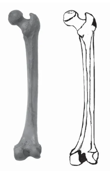 Figure 3. Type I (parallel) of the linea aspera.