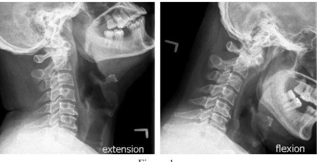 Figure 1. Figure 2. 