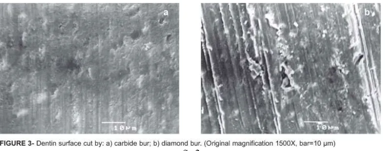 fig 2 Fig 2 shows the morphology of smear layer produced by a carbide and diamond bur.(13) 