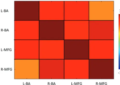 FIG 4. Group-level functional connectivity between the bilateral BAand MFG regions across patients