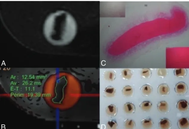 FIG 1. A, MR images of 3D-CISS analog thrombi. B, MR images of coregistered T2 mapping and3D-CISS analog thrombus
