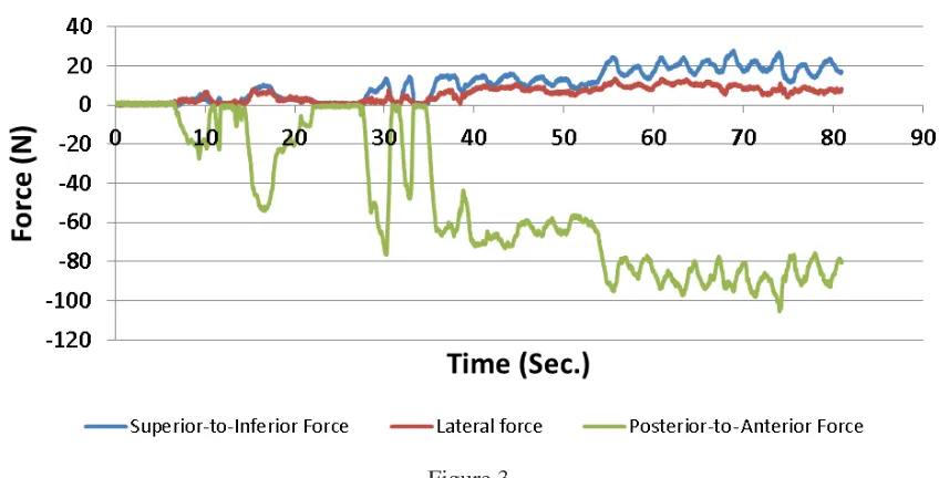 Figure 3. A typical Force time graph displayed by the computer and the clinician’s ability to alter the forces