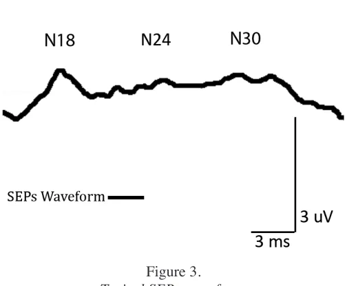 Figure 3. brain stem, thalamic, and pontine lesions. A review by Typical SEPs waveform.Sonoo50 expanded on the mechanism for the N18 peak