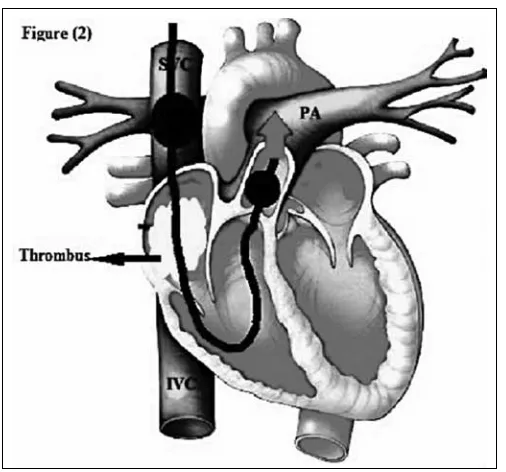 Fig. 1. MP-04.14.