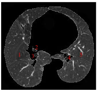 Figure 4.8 The statics of lung and trachea 