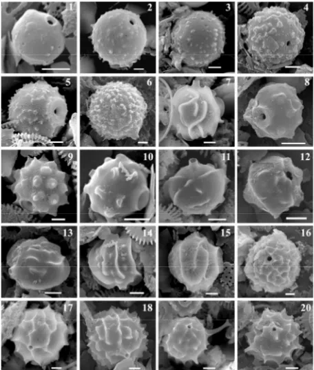 Figure 3. Novel morphotypes of chrysophycean stomato-cysts found in the Upper Pleistocene to Holocene sediments Firsova; (4) StomatoНFirsova; (6) StomatoFirsova; (8) StomatoFirsova; (10) Stomatofrom Lake Hovsgol (SEM images): (1) Stomatoсyst Н8 Firsova; (2