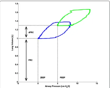 Figure 2 Schematic showing the difference between FRC and dFRC.