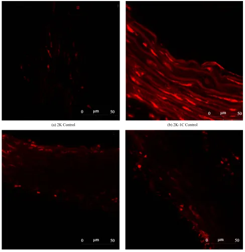 Figure 5. Representative images from confocal microscopy of the ROS content in the aortic rings tissue detected by dihydro-ethidium (DHE) staining