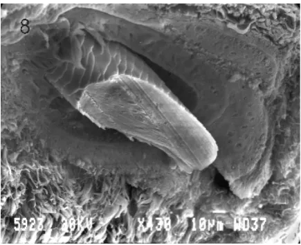Figure 8. Scanning electron micrograph of a transverse section ofa convex hair.