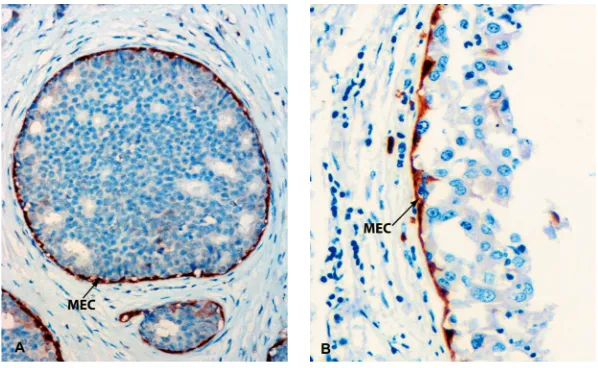 Figure 4. The structure of terminal end buds (TEB) (A) and ductal and alveolar cells during pregnancy (B)