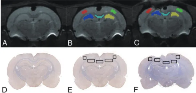 FIG 1. Illustration of ROIs on B0 (A–C) and histology (D–F) maps for a representative control andTBI rat