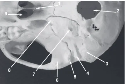 Figure 1. Localization of the macaque’s temporal bone in the neuroc-ranium and viscerocranium